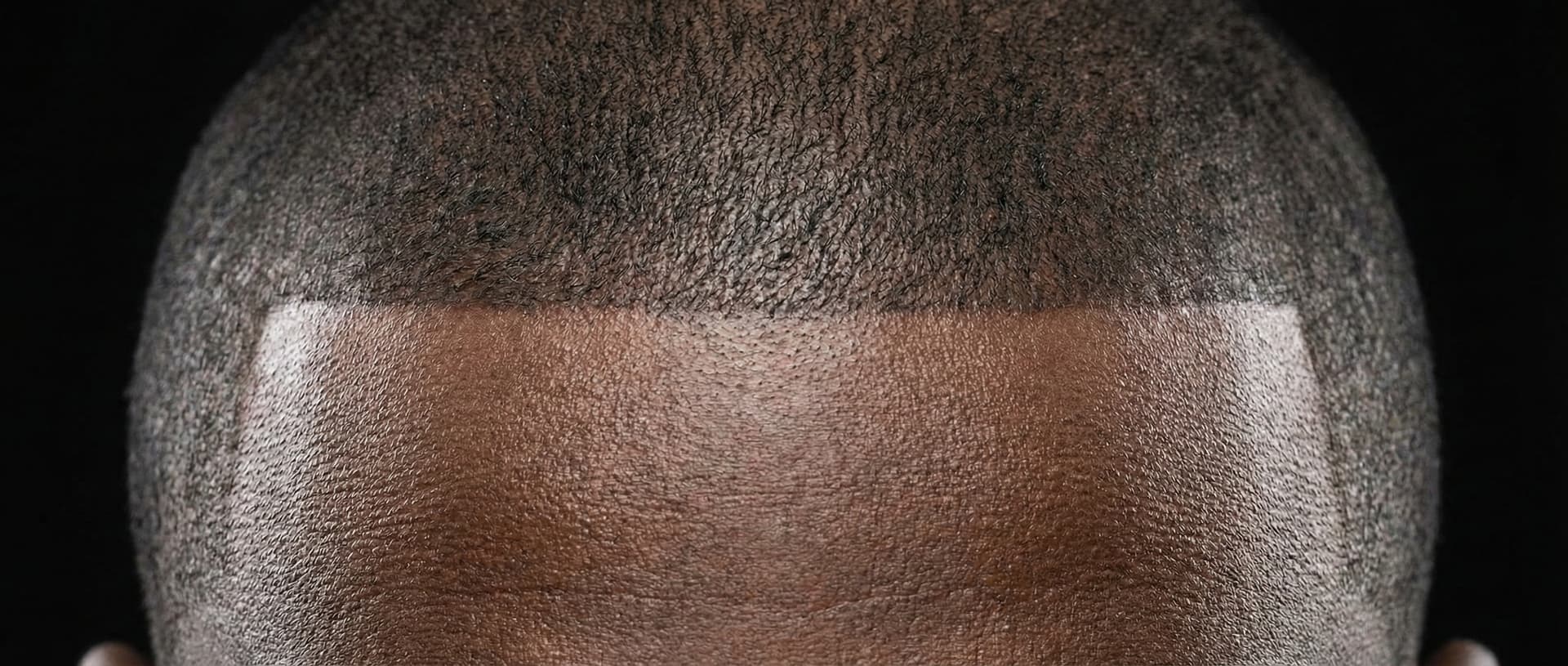 Sharp Edge-Up diagram