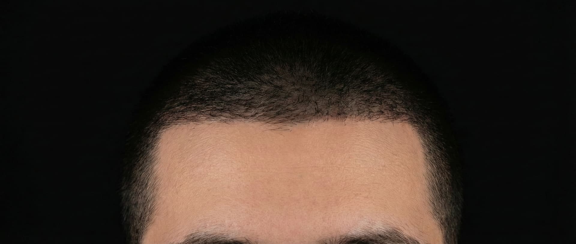 Straight Edge diagram