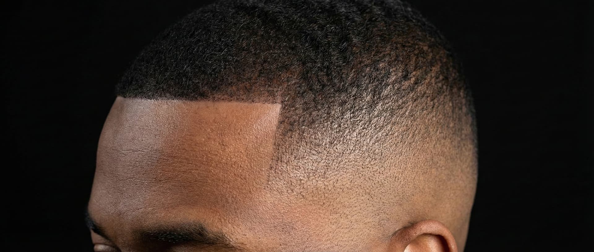 Temple Fade Blend diagram