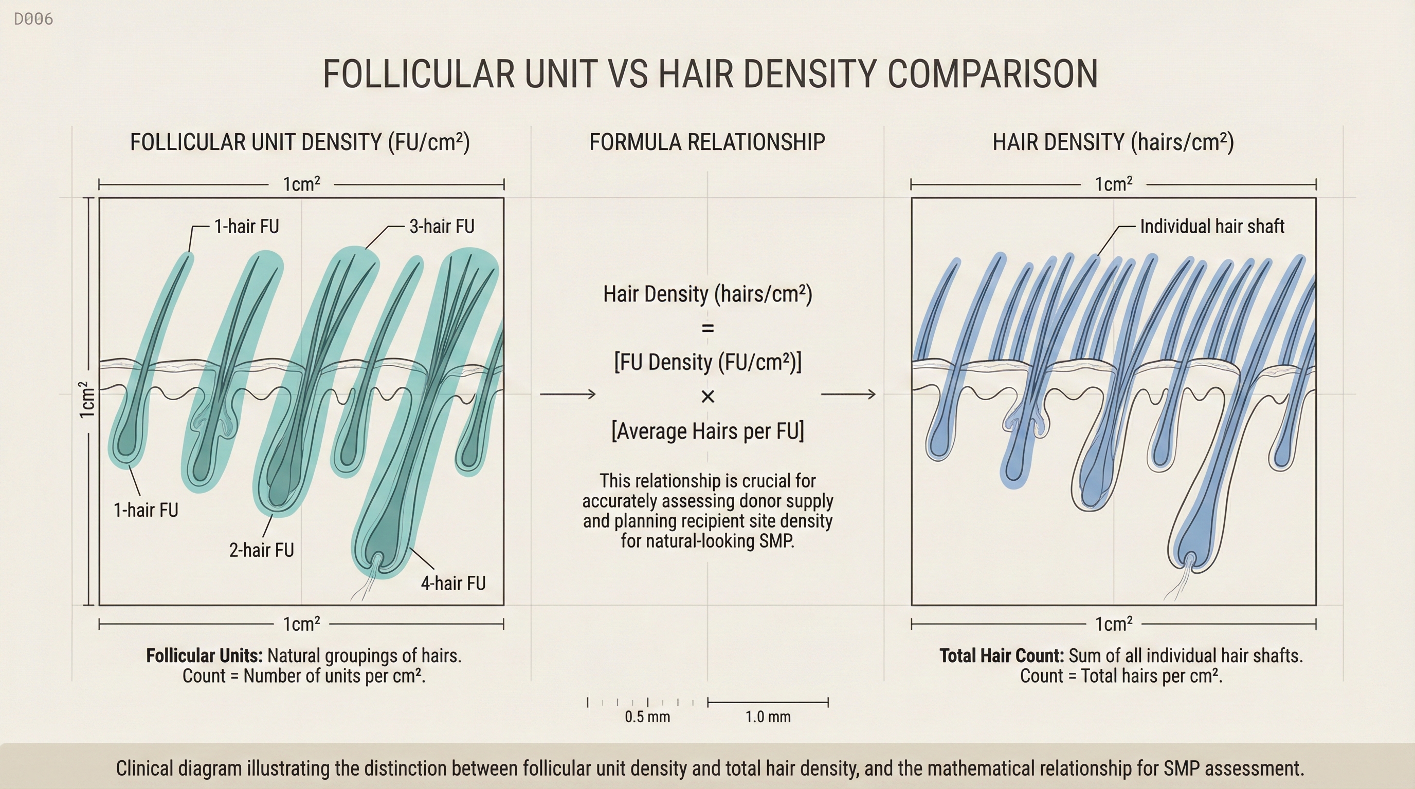 Follicular Unit vs Hair Density — Visual comparison showing FU count vs individual hair count